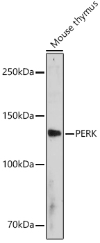 PERK Polyclonal Antibody