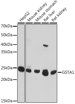 GSTA1 Polyclonal Antibody