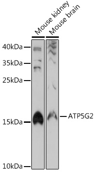 ATP5G2 Polyclonal Antibody