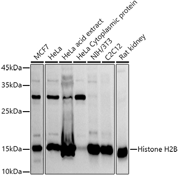Histone H2B Polyclonal Antibody