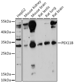 PEX11B Polyclonal Antibody