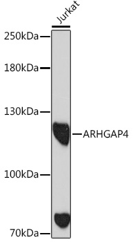 ARHGAP4 Polyclonal Antibody