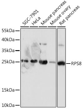 RPS8 Polyclonal Antibody