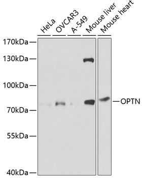 OPTN Polyclonal Antibody