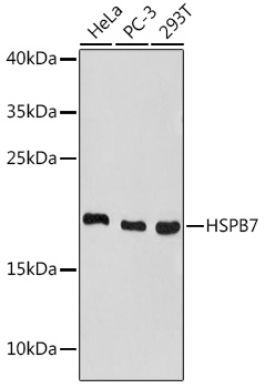 HSPB7 Polyclonal Antibody