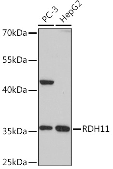 RDH11 Polyclonal Antibody