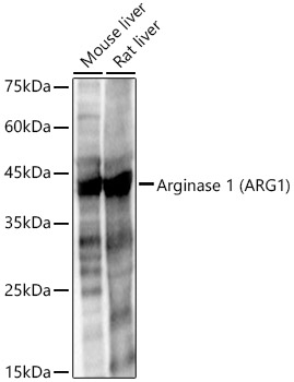 Arginase 1 (ARG1) Polyclonal Antibody