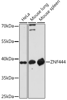 ZNF444 Polyclonal Antibody