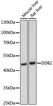DDB2 Polyclonal Antibody