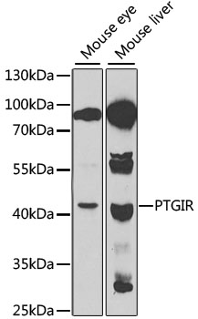 PTGIR Polyclonal Antibody