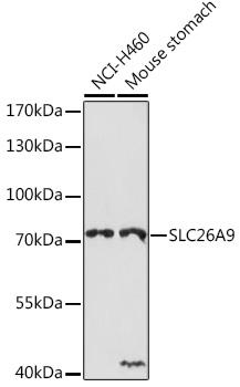 SLC26A9 Polyclonal Antibody
