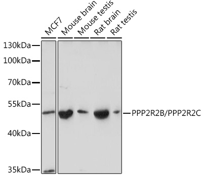 PPP2R2B/PPP2R2C Polyclonal Antibody