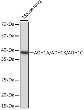 ADH1A/ADH1B/ADH1C Polyclonal Antibody&nbsp;<img src="images/icon_newarrival.gif" alt="new" border="0">
