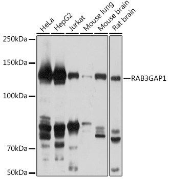RAB3GAP1 Polyclonal Antibody