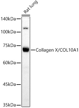Collagen X/COL10A1 Polyclonal Antibody