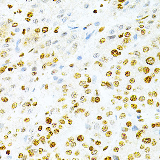 DKC1 Polyclonal Antibody