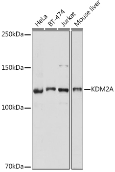 KDM2A Polyclonal Antibody