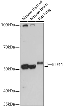 KLF11 Polyclonal Antibody
