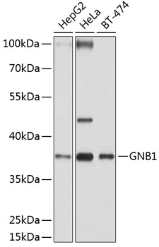 GNB1 Polyclonal Antibody