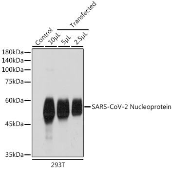 SARS-CoV-2 Nucleoprotein Polyclonal Antibody