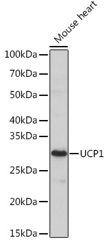 UCP1 Polyclonal Antibody