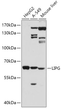 LIPG Polyclonal Antibody