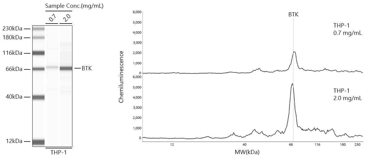 BTK Monoclonal Antibody [2J9O8]