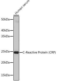 C-Reactive Protein (CRP) Monoclonal Antibody [10J2R8]