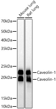 Caveolin-1 Monoclonal Antibody [10Y5L2]