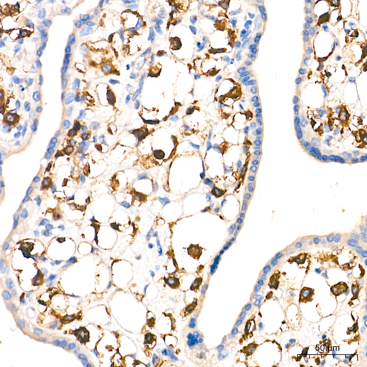CD14 Monoclonal Antibody [0F2Q7]