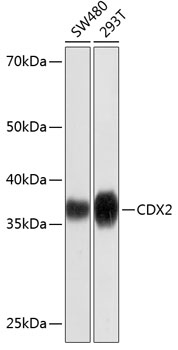 CDX2 Monoclonal Antibody [9E0K5]