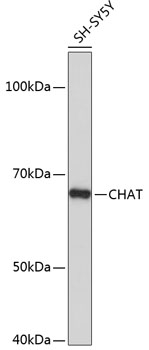 ChAT Monoclonal Antibody [1I4V0]