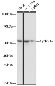 Cyclin A2 Monoclonal Antibody [3E9Z3]