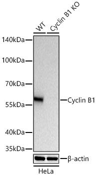 Cyclin B1 Monoclonal Antibody [1Q3E9]