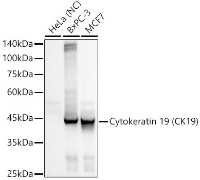 Cytokeratin 19 (CK19) Monoclonal Antibody [2Q5A5]