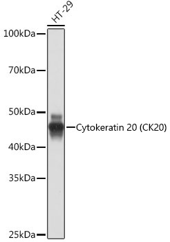 Cytokeratin 20 (CK20) Monoclonal Antibody [8C6A3]