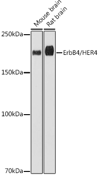 ErbB4/HER4 Monoclonal Antibody [8E5D0]