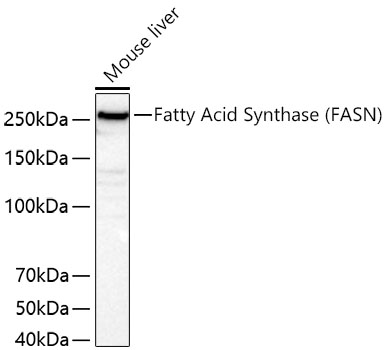 Fatty Acid Synthase (FASN) Monoclonal Antibody [4U9S3]