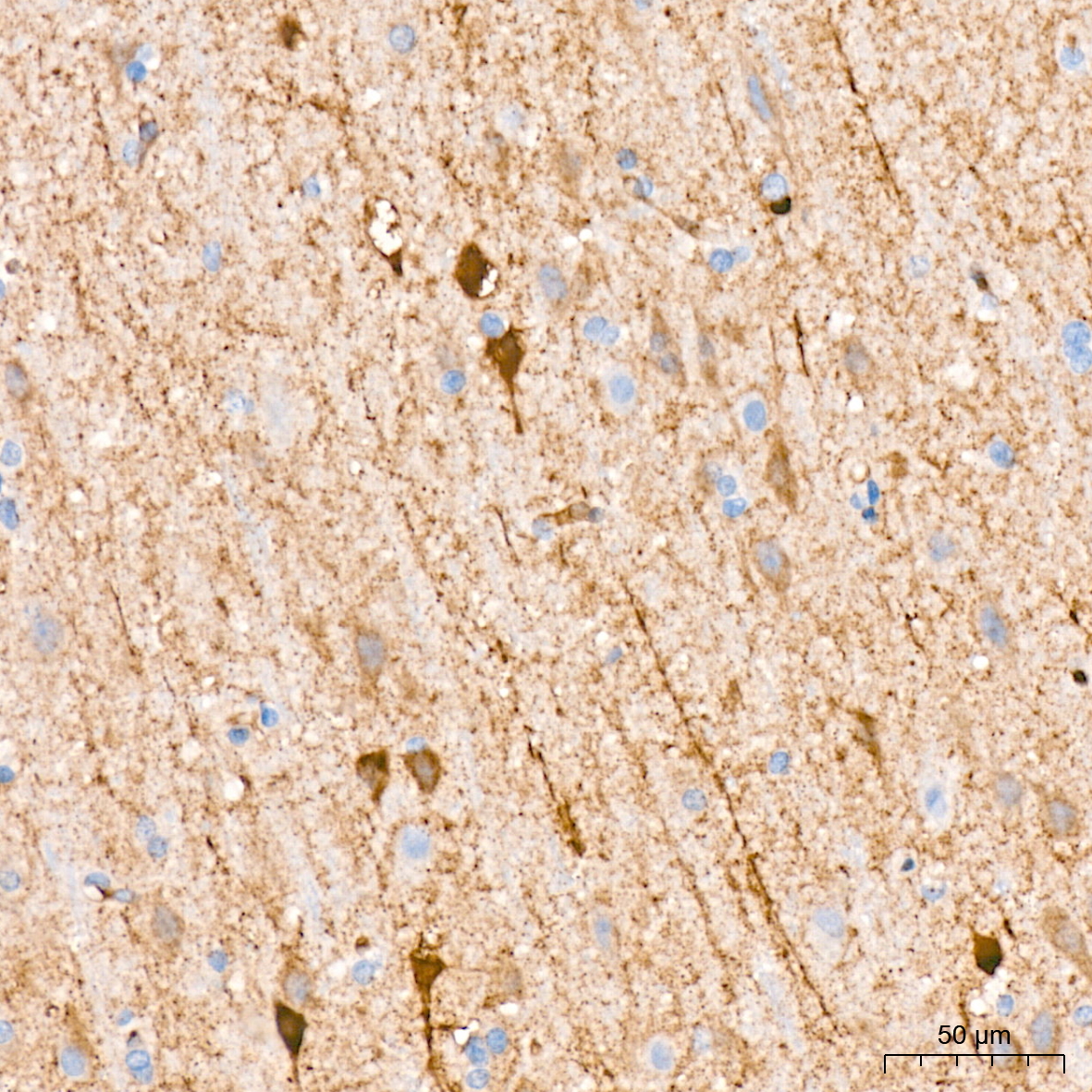 FGFR3 Monoclonal Antibody [2V1Z6]