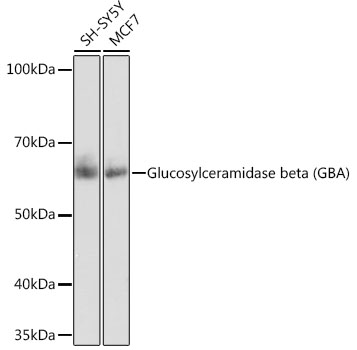 Glucosylceramidase beta (GBA) Monoclonal Antibody [8O3Z7]