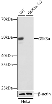 GSK3a Monoclonal Antibody [4I10Q9]
