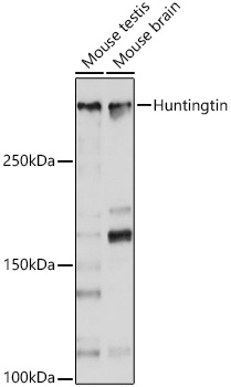 Huntingtin Monoclonal Antibody [7B9C8]