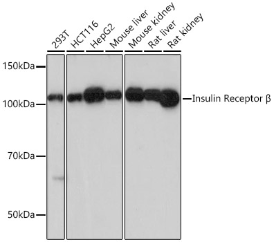 Insulin Receptor Monoclonal Antibody [1F1B6]
