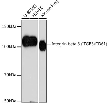Integrin beta 3 (ITGB3/CD61) Monoclonal Antibody [7D5N1]