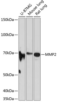 MMP2 Monoclonal Antibody [3Q7R10]