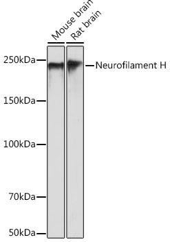 Neurofilament H Monoclonal Antibody [7L2V7]