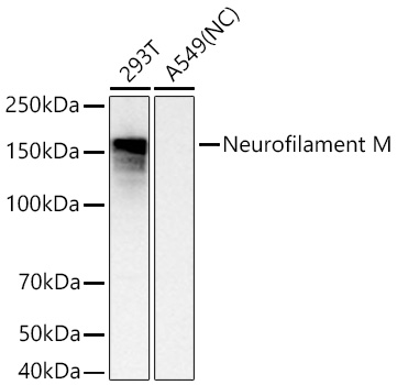 Neurofilament M Monoclonal Antibody [5E0D2]
