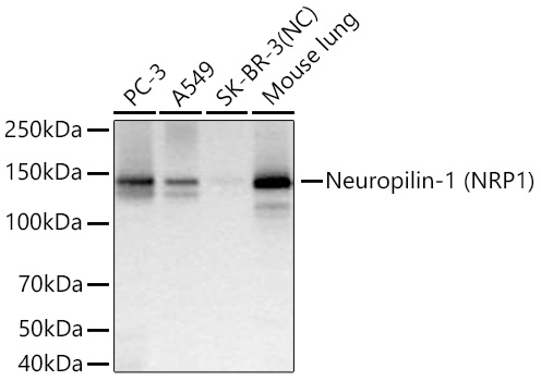 Neuropilin-1 (NRP1) Monoclonal Antibody