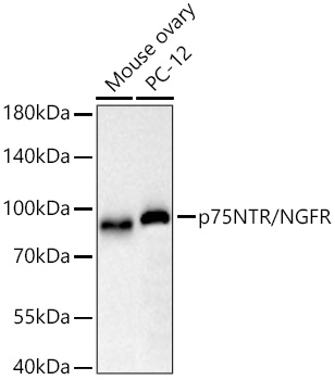 p75NTR/NGFR Monoclonal Antibody [2H6Q6]