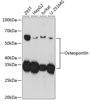 Osteopontin Monoclonal Antibody [5E3A6]